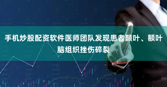 手机炒股配资软件医师团队发现患者颞叶、额叶脑组织挫伤碎裂